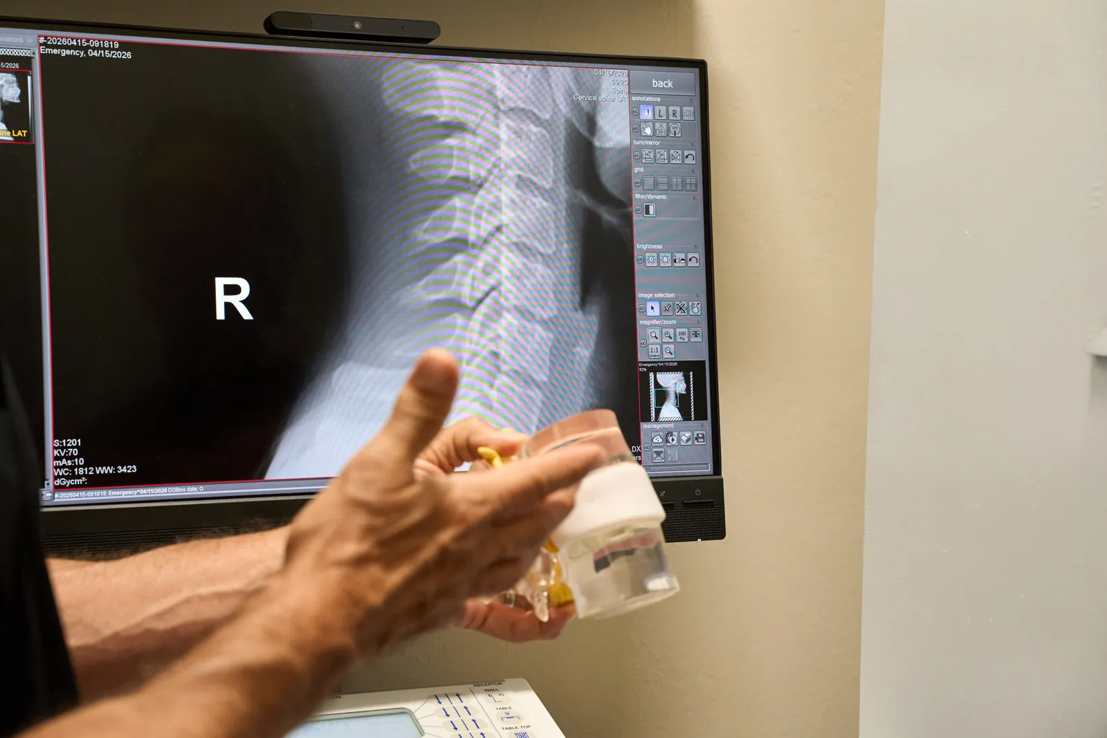 Dr. Ivan Bracic reviewing a cervical spine X-ray with a patient after a car accident at Novaré Injury Care and Rehab